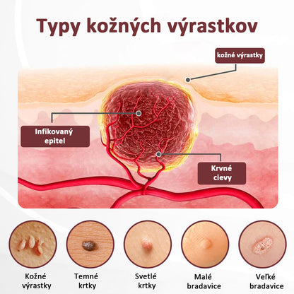 Biancat®KeraErase regeneračný krém s dvojitým účinkom
